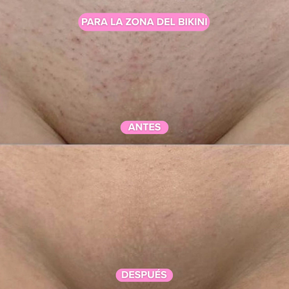 Depiladora Nuvella®